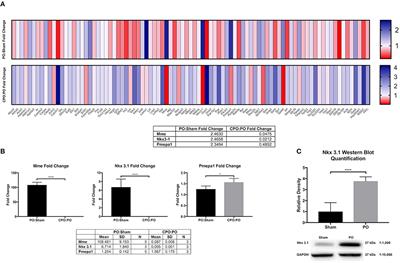 The Homeodomain Transcription Factor NKX3.1 Modulates Bladder Outlet Obstruction Induced Fibrosis in Mice